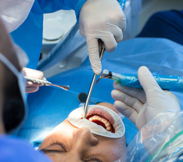 جراحی دندان