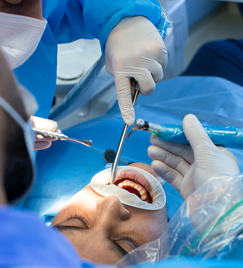 جراحی دندان